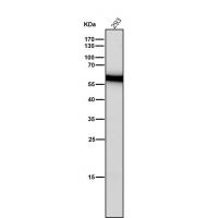 Estrogen Receptor beta Rabbit mAb