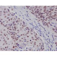Estrogen Receptor beta Rabbit mAb