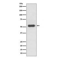 Estrogen Receptor beta Rabbit mAb