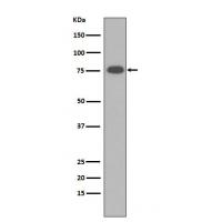 Vitronectin Rabbit mAb