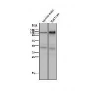 PSD93 Rabbit mAb