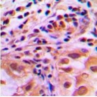 FKHR(Phospho-Ser256) Antibody