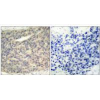 LIMK1(Phospho-Thr508) Antibody