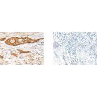 GPSM1 Antibody