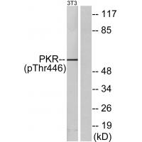 PKR(Phospho-Thr446) Antibody