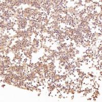 LRP1 Rabbit mAb