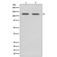 CD146 Rabbit mAb