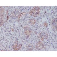 CD146 Rabbit mAb