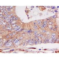 Cadherin Rabbit mAb