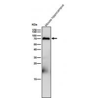 PCPTP1 Rabbit mAb