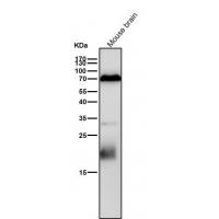 PCPTP1 Rabbit mAb