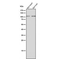 Thrombopoietin Receptor Rabbit mAb
