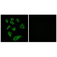 CYP2W1 Polyclonal Antibody