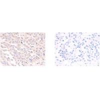 SLC39A6 Antibody