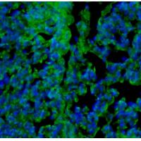 TAP1 antibody