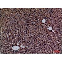 Glypican-3 Polyclonal Antibody