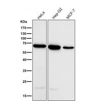 ACADVL/VLCAD Rabbit mAb