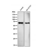 ACADVL/VLCAD Rabbit mAb