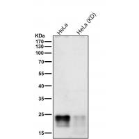 Phospho-eIF4EBP1/2/3 (T46+T46+T32) Rabbit mAb