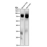PKC delta + PKC theta Rabbit  mAb