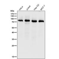 PKC delta + PKC theta Rabbit  mAb