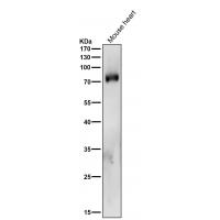 PKC delta + PKC theta Rabbit  mAb