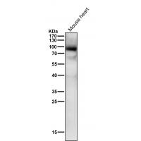 Phospho-PKC alpha (T497) Rabbit mAb