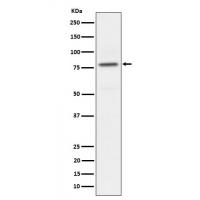 Phospho-PKC alpha (T497) Rabbit mAb