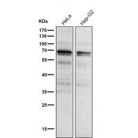 Phospho-PKC alpha (T497) Rabbit mAb