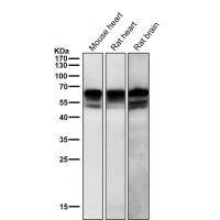 Phospho-Src (Y529) Rabbit mAb