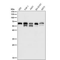 Phospho-Src (Y529) Rabbit mAb