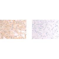 CHDH Antibody