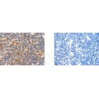 CHDH Antibody