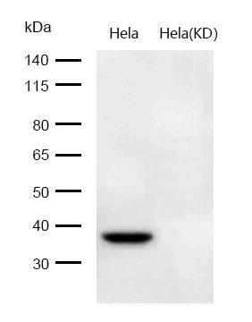 alpha smooth muscle Actin Rabbit mAb
