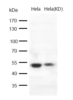 GSK3 beta Rabbit mAb