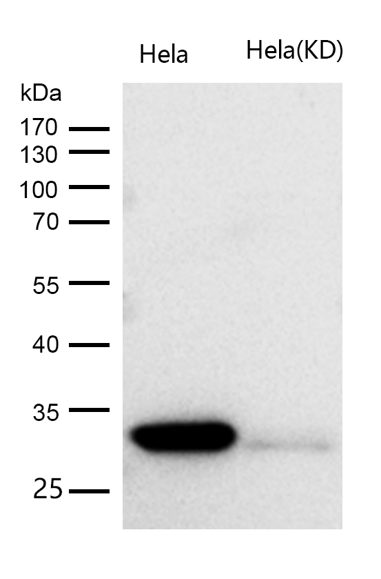 CDK2 Rabbit mAb
