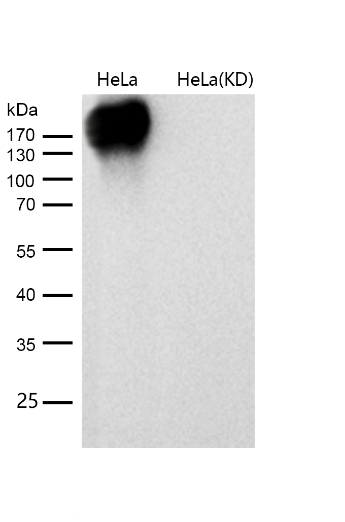 EGFR (ErbB 1) Rabbit mAb