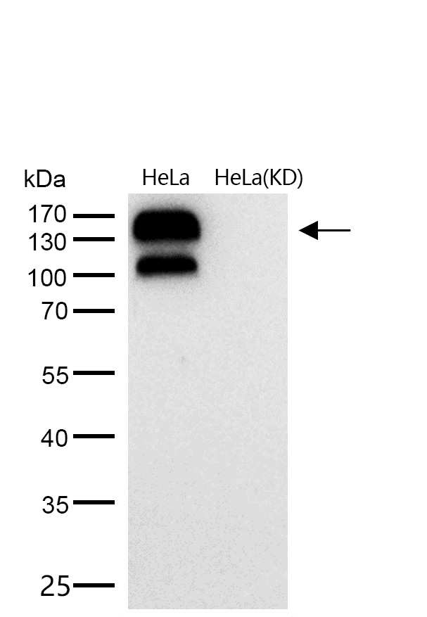 Integrin beta 1 Rabbit mAb