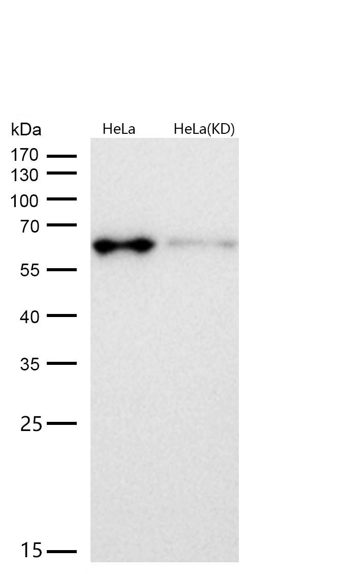 AMPK alpha 1 Rabbit mAb