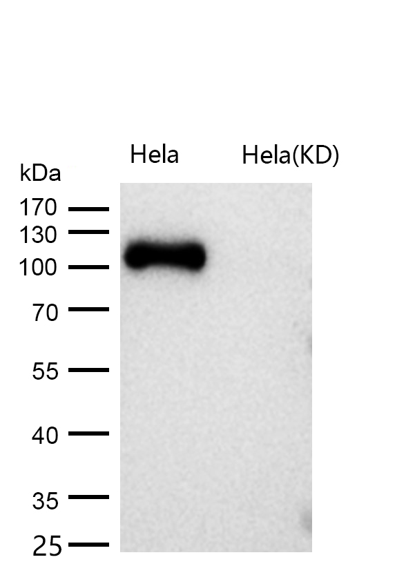 Androgen Receptor Rabbit mAb