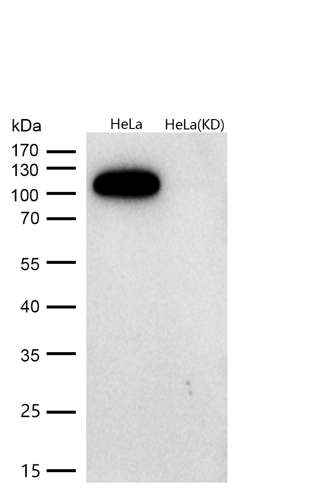 Hexokinase 1 Rabbit mAb