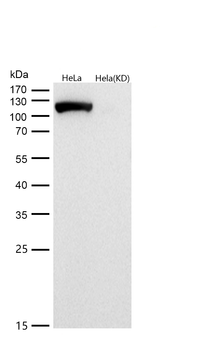 ATP citrate lyase Rabbit mAb 