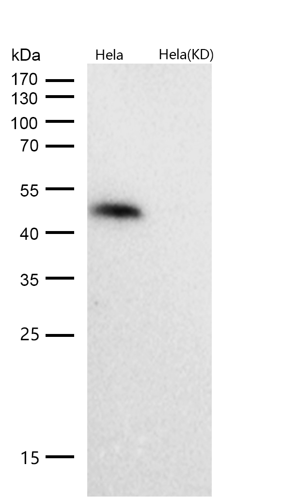 HDAC3 Rabbit mAb