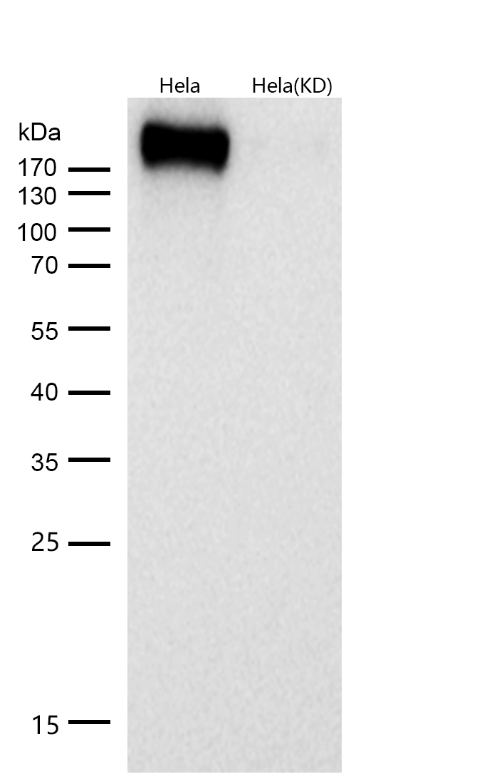 Tuberin Rabbit mAb 