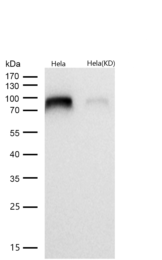 IKK alpha Rabbit mAb