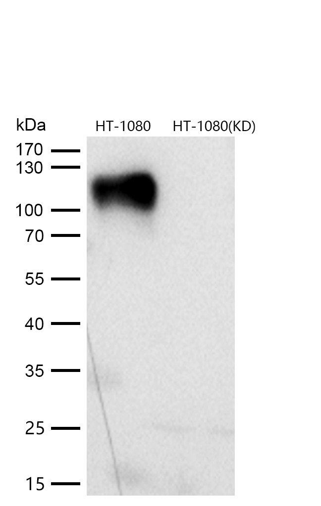 LAMP1 Rabbit mAb