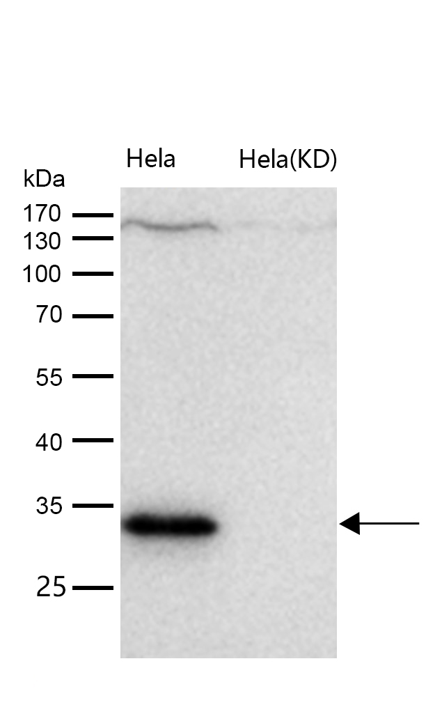 CD99 Rabbit mAb