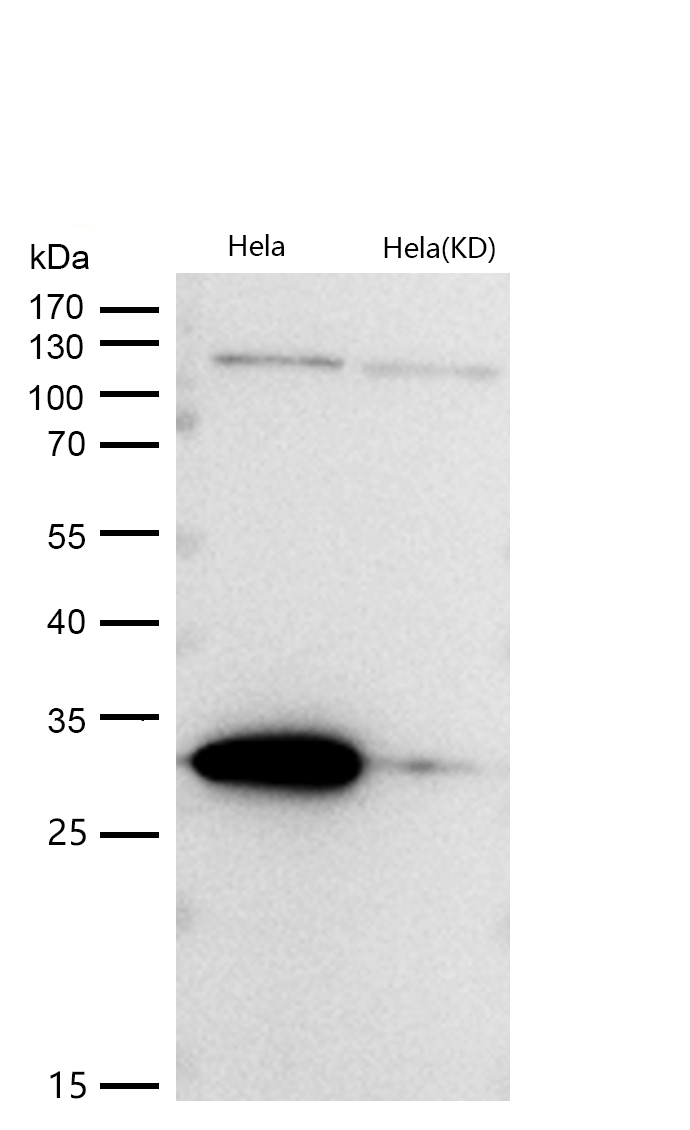 Galectin 3 Rabbit mAb
