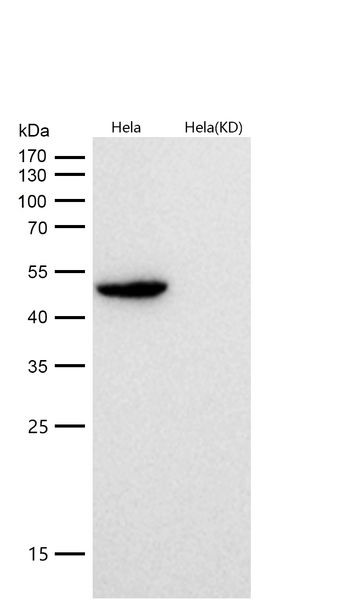 G6PD Rabbit mAb