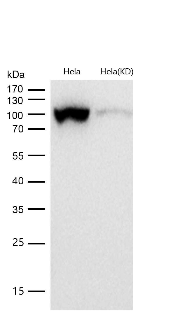DNA Ligase IV Rabbit mAb